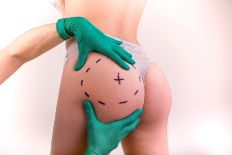 img-gluteo