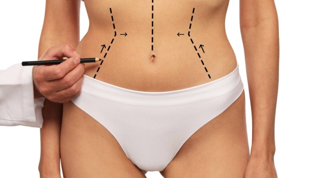 img-lipo