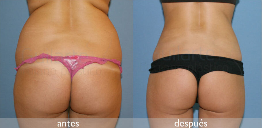 img-resultado1