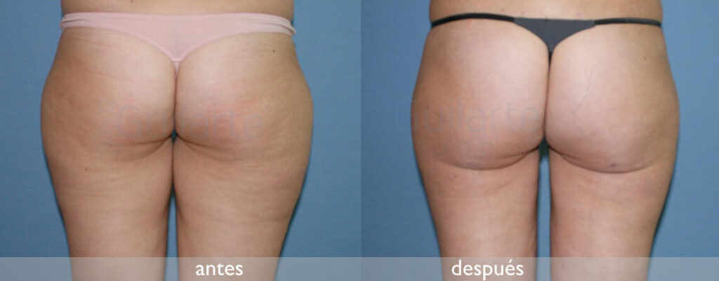 img-resultado6