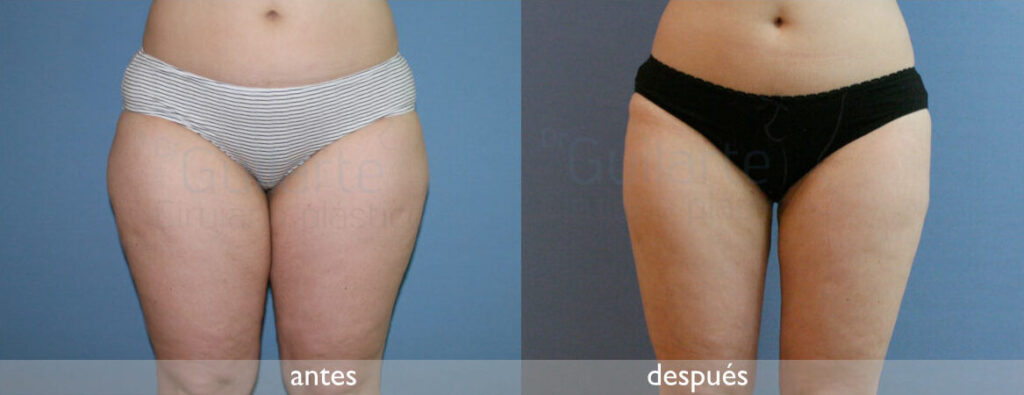 img-resultado5