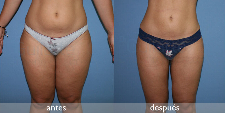 img-resultado4