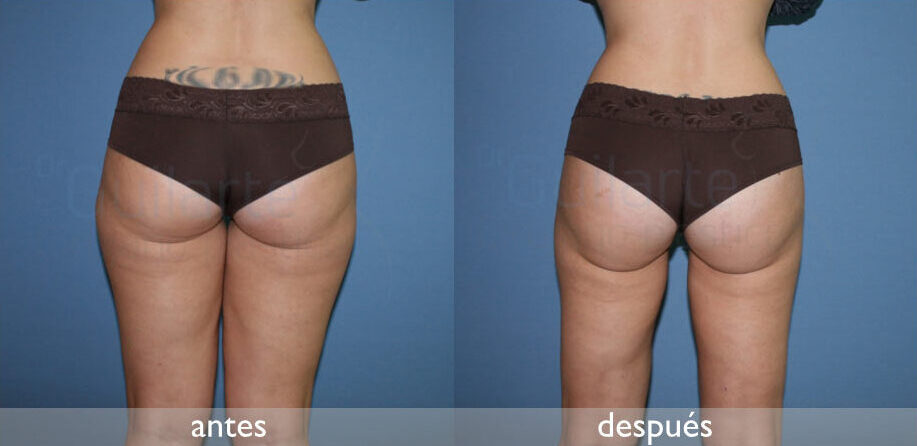 img-resultado3
