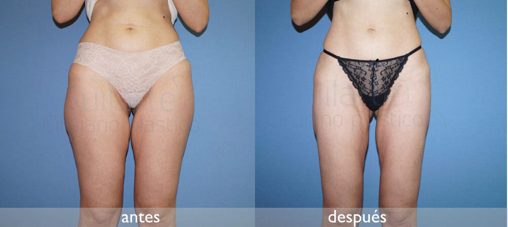 img-resultado2